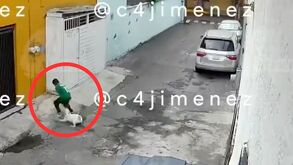 Un niño de 11 años fue atacado por un perro en calles de la alcaldía Iztapalapa, CdMx. | C4 Carlos Jiménez
