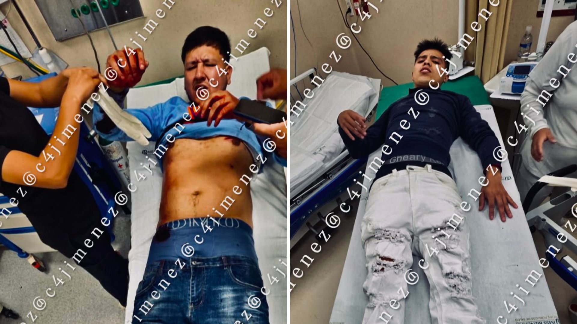 Balean a 2 de Los Fortis en Tepito y uno quedará inválido. C4 en Alerta, 17 de agosto 2026