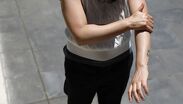 Exposición al sol dispara riesgo de cáncer de piel en adultos jóvenes