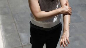 Exposición al sol dispara riesgo de cáncer de piel en adultos jóvenes