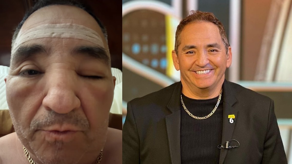 En sus redes sociales, Chavana compartió un video donde se muestra con el rostro desfigurado.