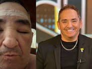 En sus redes sociales, Chavana compartió un video donde se muestra con el rostro desfigurado.