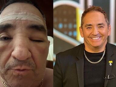 En sus redes sociales, Chavana compartió un video donde se muestra con el rostro desfigurado.