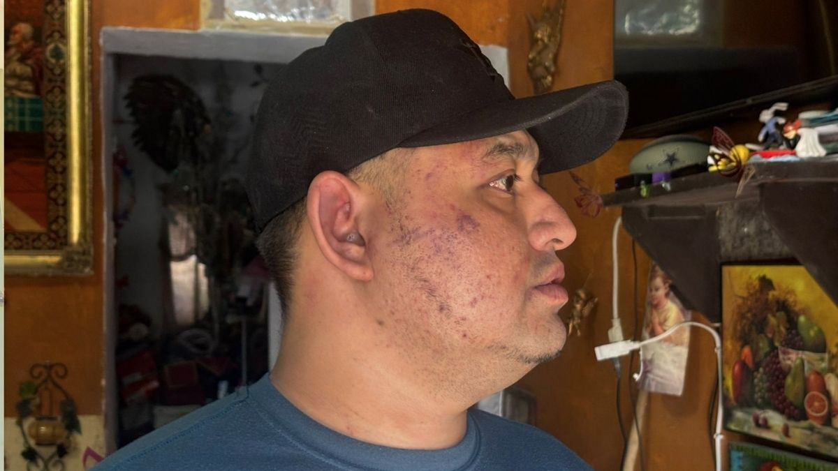El padre agredido anunció que dará seguimiento puntual a la denuncia penal ante la Fiscalía para solicitar medidas de protección de urgencia.