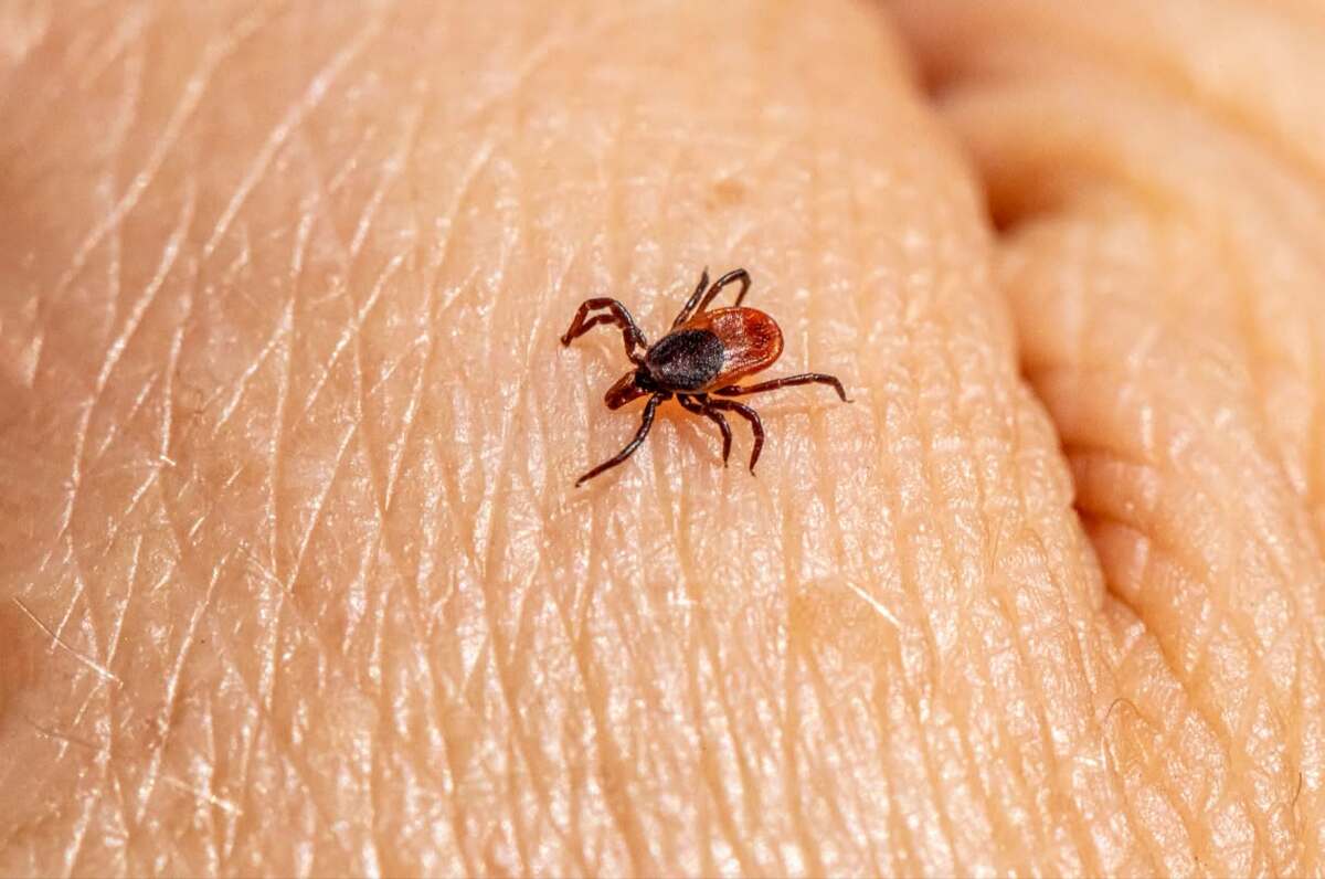 La vigilancia epidemiológica busca identificar oportunamente nuevos pacientes con síntomas compatibles.