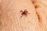 La vigilancia epidemiológica busca identificar oportunamente nuevos pacientes con síntomas compatibles.