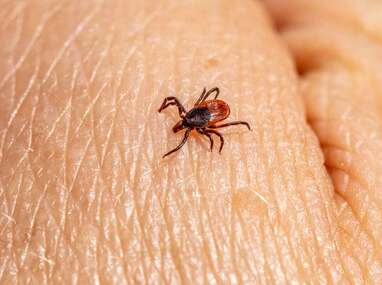 La vigilancia epidemiológica busca identificar oportunamente nuevos pacientes con síntomas compatibles.