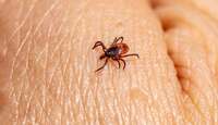 La vigilancia epidemiológica busca identificar oportunamente nuevos pacientes con síntomas compatibles.
