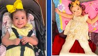 Actualmente, Romina se encuentra a la mitad de un tratamiento de seis meses para la displasia y luxación de cadera.