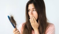 El dermatólogo Julio Salas dijo que en mujeres la caída del cabello suelen sugerir un síndrome de ovario poliquístico. | Especial
