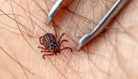 La picadura de garrapata puede ocasionar Rickettsia o la enfermedad de Lyme.
