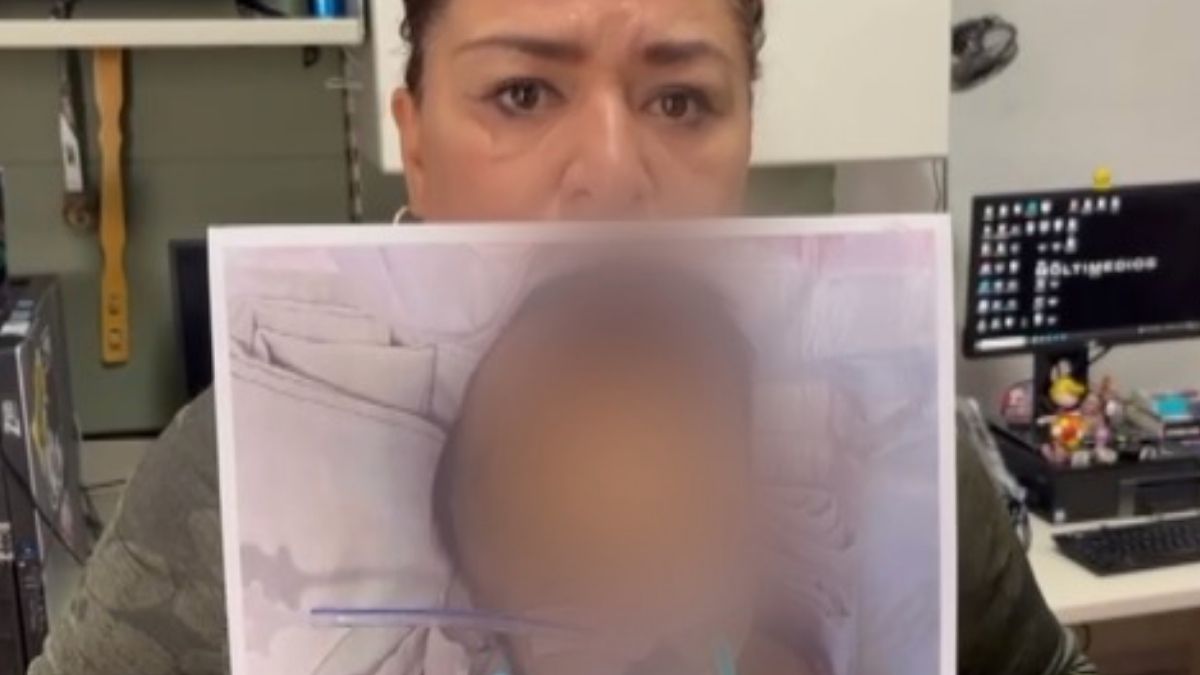 La madre de la menor señaló que en el hospital existían condiciones insalubres evidentes.