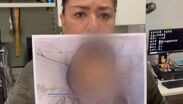 La madre de la menor señaló que en el hospital existían condiciones insalubres evidentes.