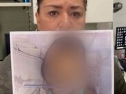 La madre de la menor señaló que en el hospital existían condiciones insalubres evidentes.