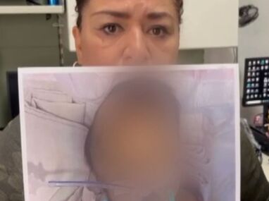 La madre de la menor señaló que en el hospital existían condiciones insalubres evidentes.