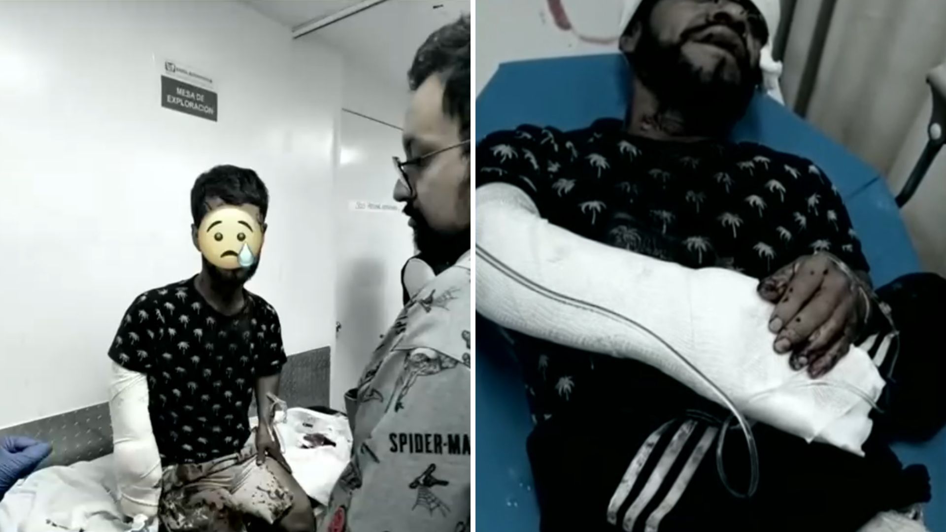 Negligencia médica en CdMx: Víctima de asalto con machete lleva 24 horas esperando cirugía urgente. TD Nocturno CdMx, 25 de septiembre 2026