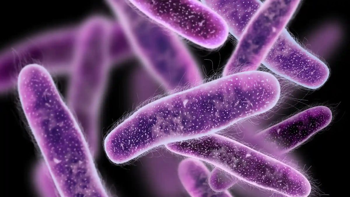 Salud Jalisco explica cuándo varios casos de Klebsiella podrían constituir un brote