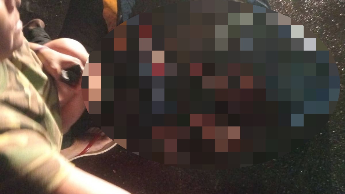 El diagnóstico preliminar señala una probable fractura de cráneo con sangrado por los oídos.