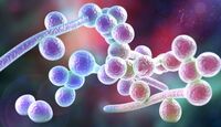 Investigan un brote de Klebsiella pneumoniae y Candida albicans en Guadalajara.