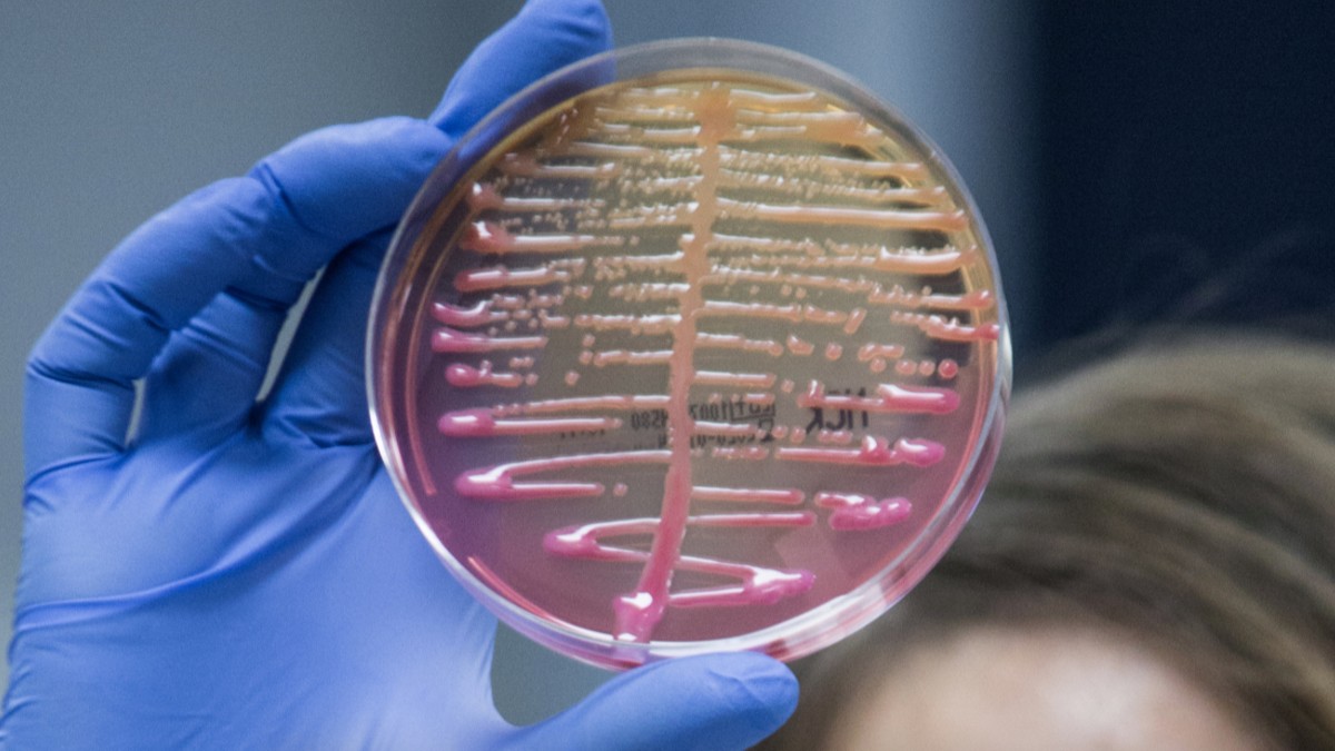 La bacteria Klebsiella pneumoniae puede vivir en el intestino y vías respiratorias | Organización Mundial de la Salud