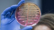 La bacteria Klebsiella pneumoniae puede vivir en el intestino y vías respiratorias | Organización Mundial de la Salud