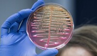 La bacteria Klebsiella pneumoniae puede vivir en el intestino y vías respiratorias | Organización Mundial de la Salud