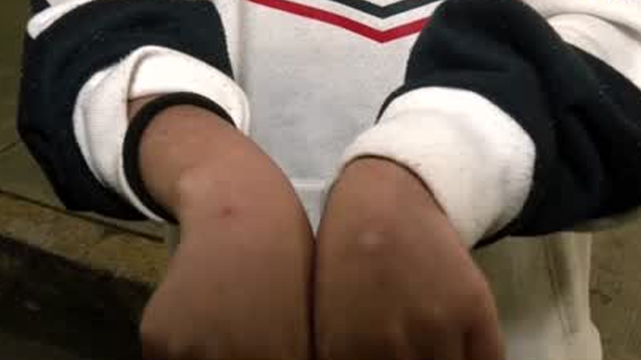 Estudiante es agredida afuera de preparatoria en Tláhuac; familia exige justicia