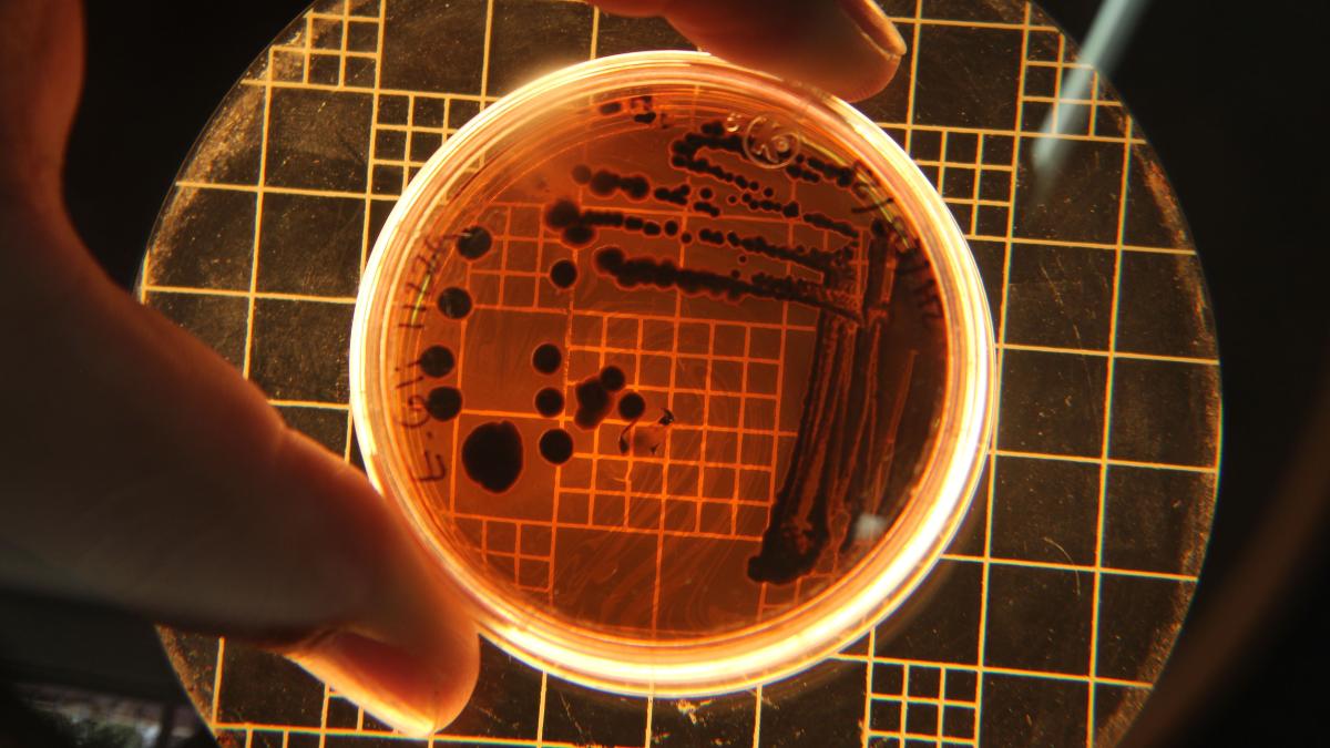 Klebsiella pneumoniae, la bacteria que habita en el intestino y en las vías respiratorias | Pexels