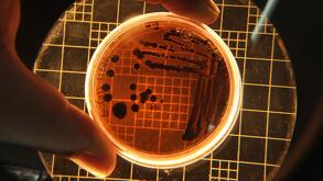 Klebsiella pneumoniae, la bacteria que habita en el intestino y en las vías respiratorias | Pexels