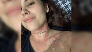 Fernanda relató que las rochan en su cuerpo le provocaban una comezón que describió como insoportable