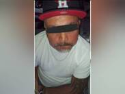 El dictamen médico señaló que el hombre presentaba un estado de ebriedad completa al ser detenido.