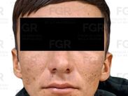 El hombre aseguró que se trataba de medicamento, aunque no contaba con el permiso ni la documentación correspondiente.