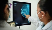 El Instituto Mexicano del Seguro Social ha reforzado estrategias para promover acciones de detección del cáncer de mama.