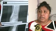 Noemí pide apoyo tras accidente en moto de aplicación en Chalco.