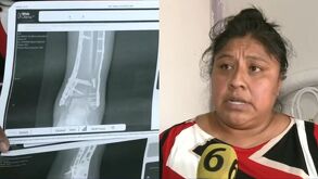 Noemí pide apoyo tras accidente en moto de aplicación en Chalco.