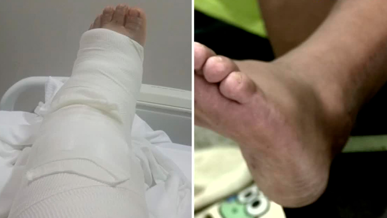 Mujer exige a DiDi cubrir gastos tras sufrir fractura en viaje en motocicleta