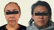 Marian 'N' y Sonia 'N' fueron detenidas por su presunta participación en procesos médicos sin acreditaciones. | Fiscalía CdMx