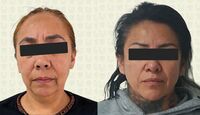 Marian 'N' y Sonia 'N' fueron detenidas por su presunta participación en procesos médicos sin acreditaciones. | Fiscalía CdMx
