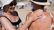 Presentan resultados de la vacuna de Moderna y MSD contra el melanoma.